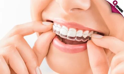 Teeth Whitening, Direct Composite Veneers & More!